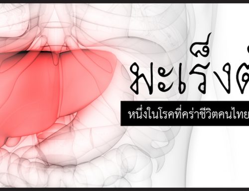 มะเร็งตับ หนึ่งในโรคที่คร่าชีวิตคนไทยมากที่สุด