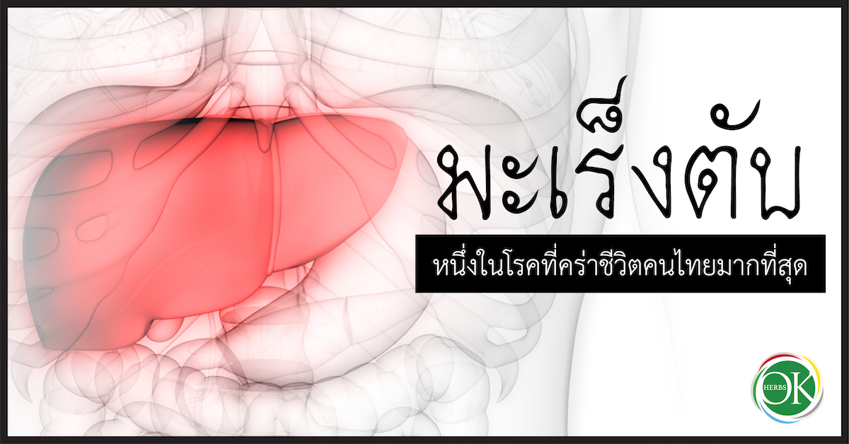 มะเร็งตับ หนึ่งในโรคที่คร่าชีวิตคนไทยมากที่สุด